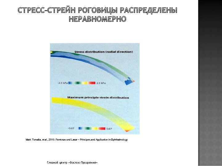 Mark Tomalla, et al. , 2010. Femtosecond Laser – Principes and Application in Ophthalmology