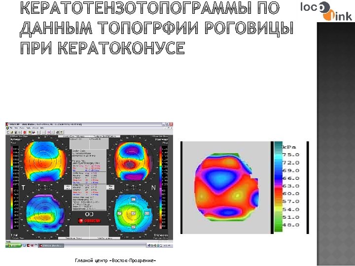Глазной центр «Восток-Прозрение» 