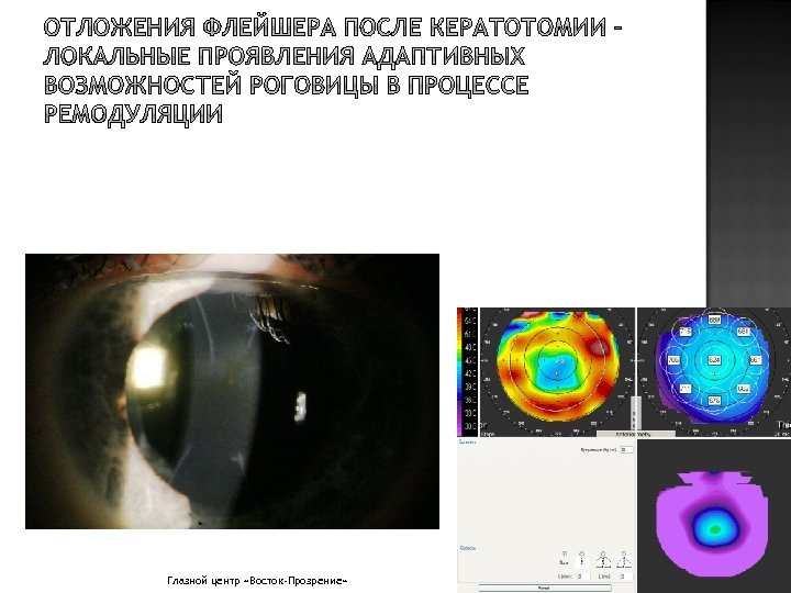 Глазной центр «Восток-Прозрение» 