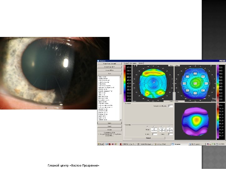 Глазной центр «Восток-Прозрение» 