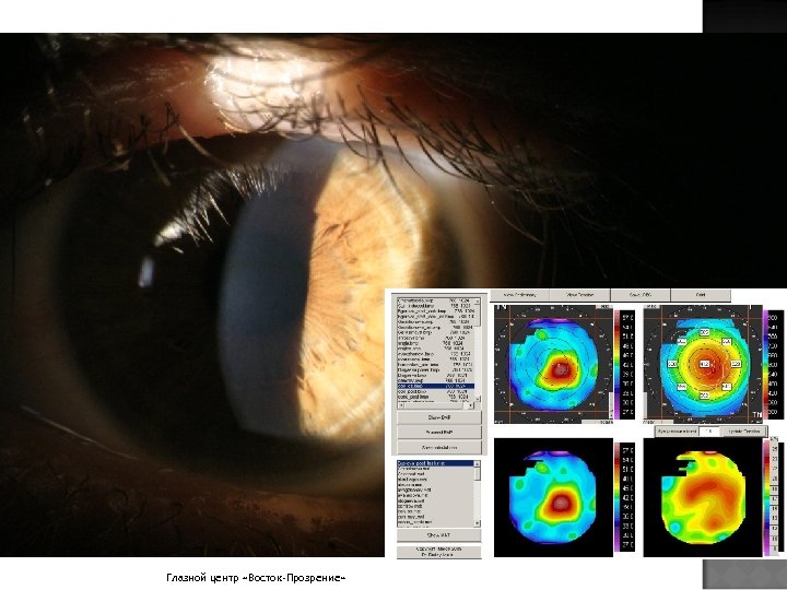 Глазной центр «Восток-Прозрение» 