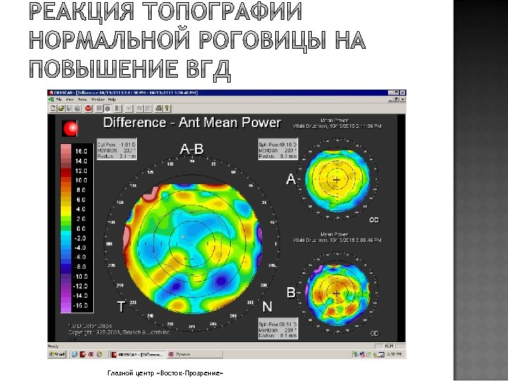 Глазной центр «Восток-Прозрение» 