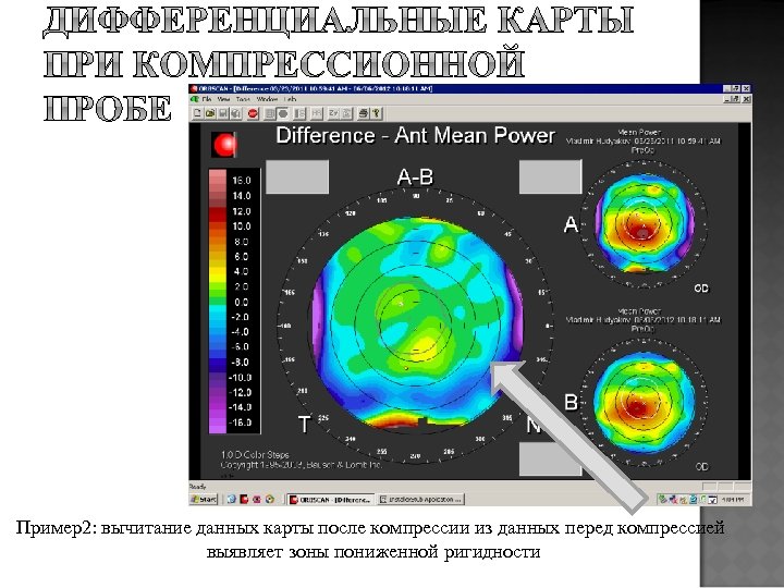 Пример2: вычитание данных карты после компрессии из данных перед компрессией выявляет зоны пониженной ригидности