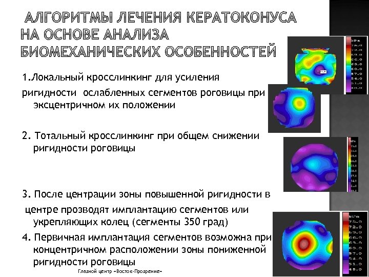 Презентация на тему кератоконус