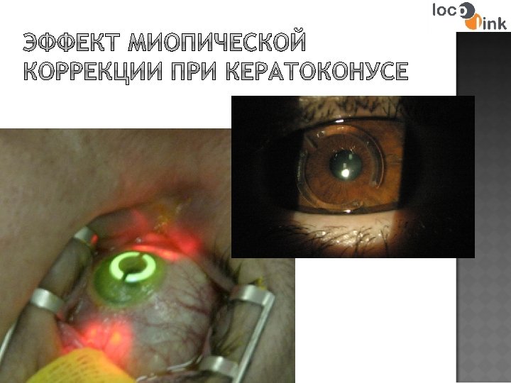 Глазной центр "Восток-Прозрение» 