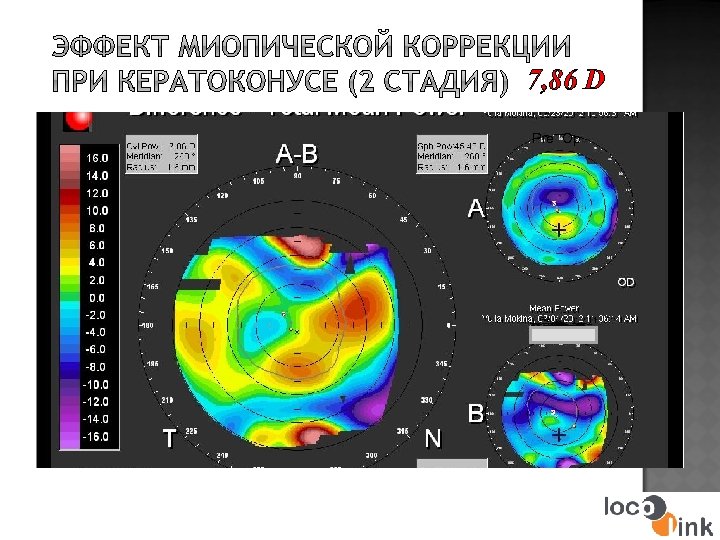 7, 86 D Pre Op Post. Op 