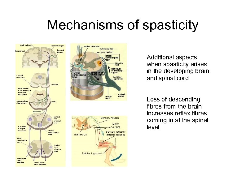 Mechanisms of spasticity Additional aspects when spasticity arises in the developing brain and spinal