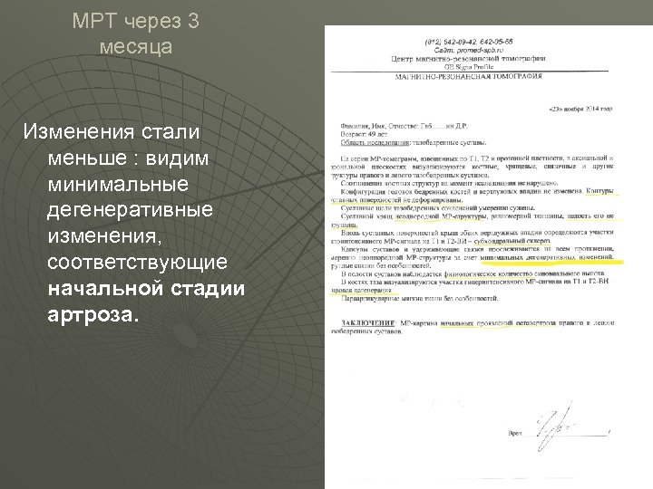 МРТ через 3 месяца Изменения стали меньше : видим минимальные дегенеративные изменения, соответствующие начальной