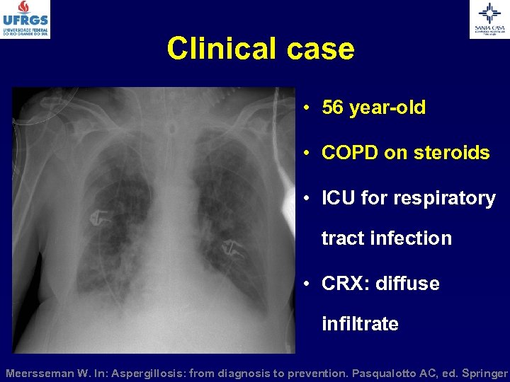 Clinical case • 56 year-old • COPD on steroids • ICU for respiratory tract
