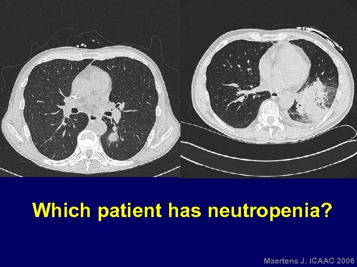 Which patient has neutropenia? Maertens J. ICAAC 2006 
