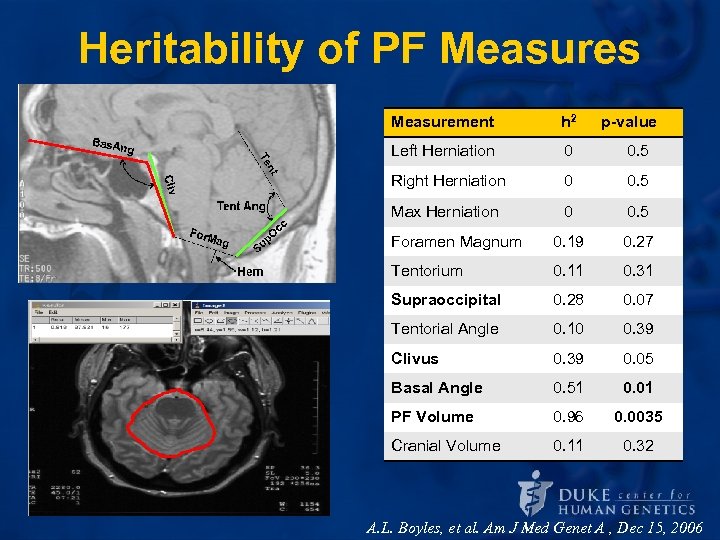 Heritability of PF Measures Measurement h 2 p-value Left Herniation 0 0. 5 Right