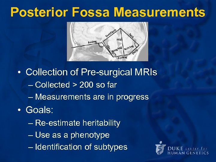 Posterior Fossa Measurements • Collection of Pre-surgical MRIs – Collected > 200 so far