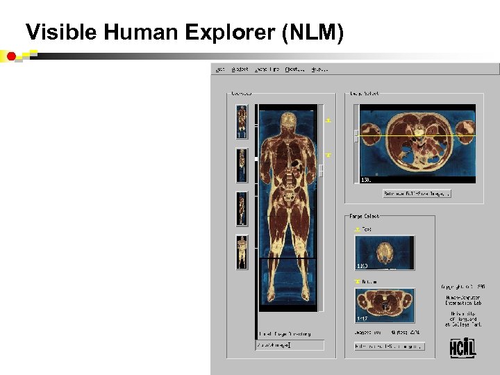 Visible Human Explorer (NLM) 