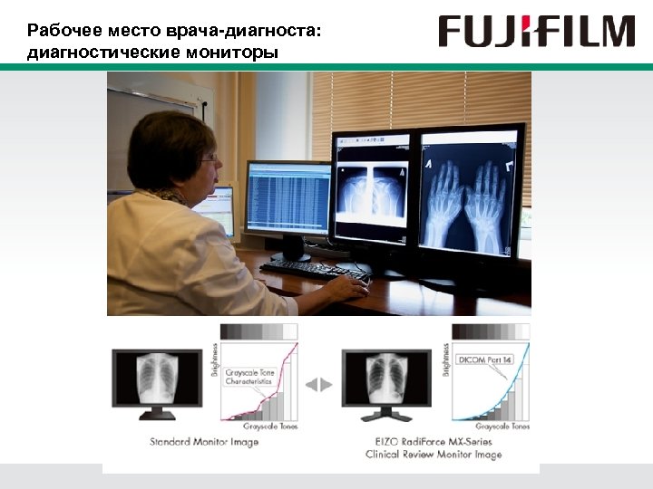 Рабочее место врача-диагноста: диагностические мониторы 