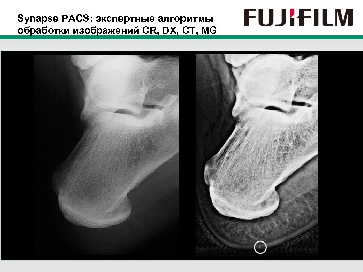 Synapse PACS: экспертные алгоритмы обработки изображений CR, DX, CT, MG 
