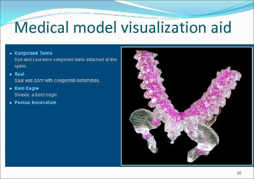 Medical model visualization aid 30 