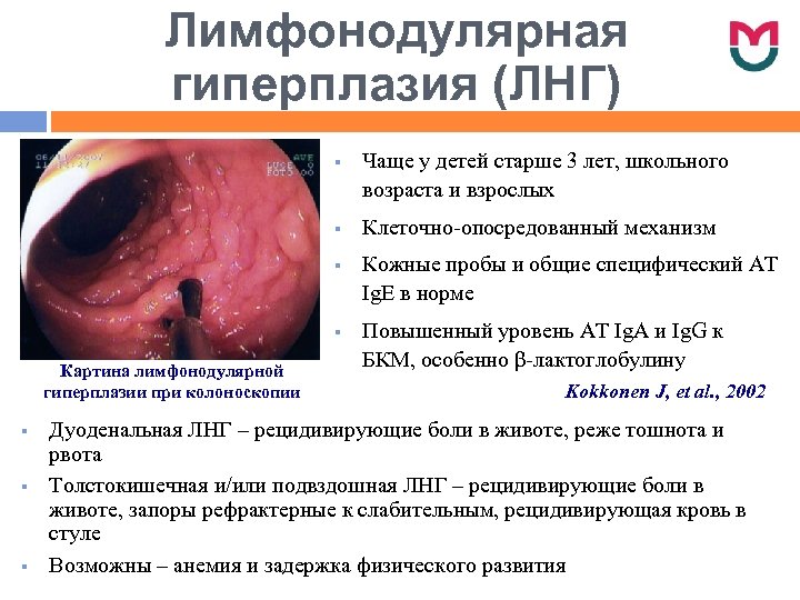Лимфонодулярная гиперплазия (ЛНГ) § § Картина лимфонодулярной гиперплазии при колоноскопии § § § Чаще