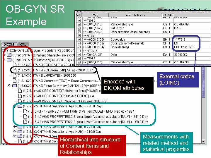 OB-GYN SR Example Encoded with DICOM attributes Hierarchical tree structure of Content Items and