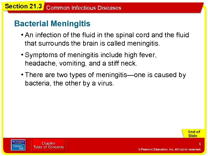 Section 21. 3 Common Infectious Diseases Bacterial Meningitis • An infection of the fluid