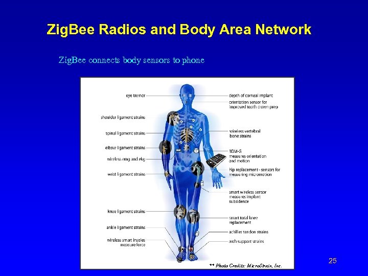 Zig. Bee Radios and Body Area Network Zig. Bee connects body sensors to phone