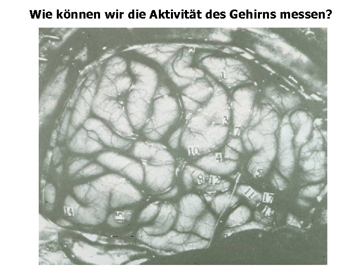 Wie können wir die Aktivität des Gehirns messen? 