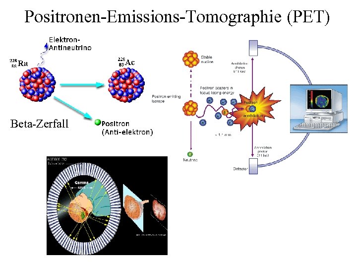 Positronen-Emissions-Tomographie (PET) Beta-Zerfall 