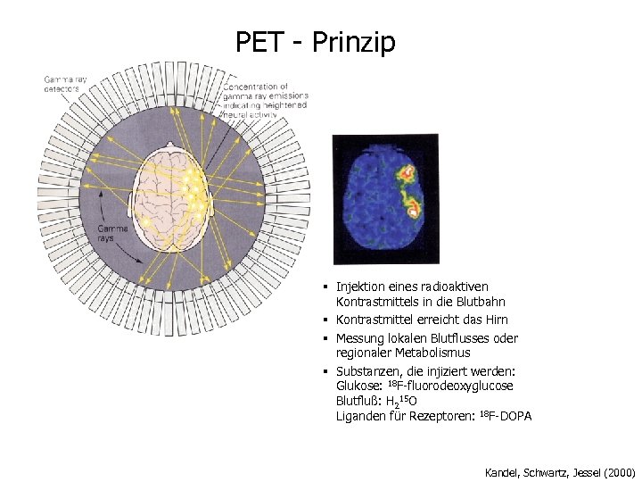PET - Prinzip § Injektion eines radioaktiven Kontrastmittels in die Blutbahn § Kontrastmittel erreicht