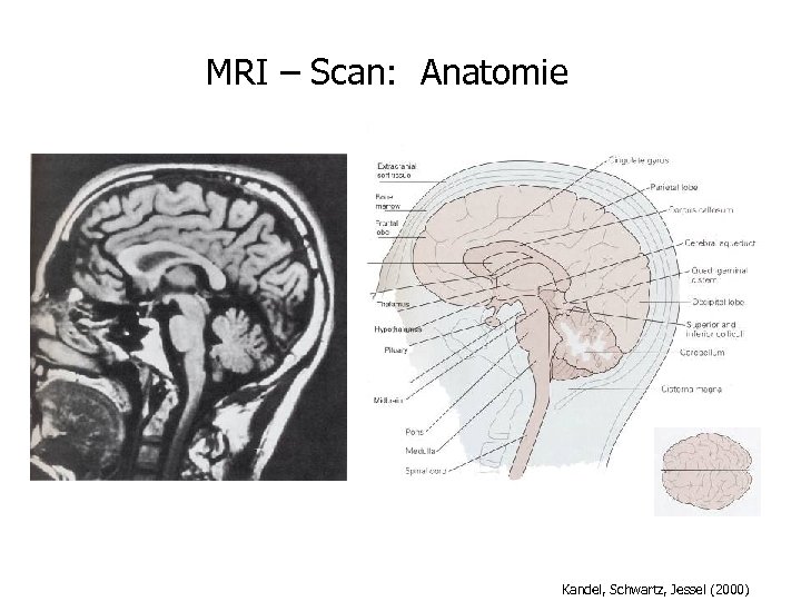 MRI – Scan: Anatomie Kandel, Schwartz, Jessel (2000) 