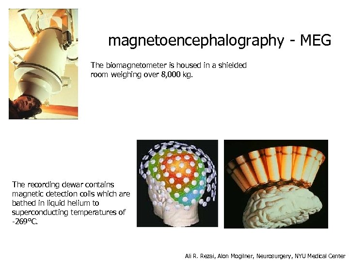 magnetoencephalography - MEG The biomagnetometer is housed in a shielded room weighing over 8,