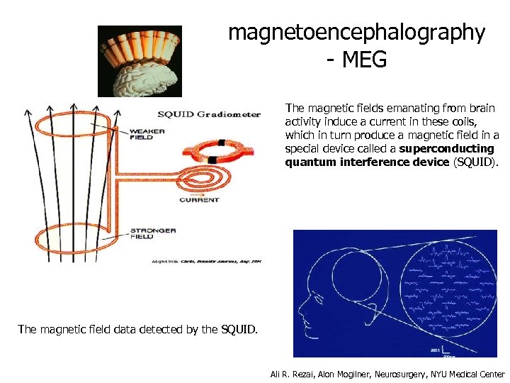 magnetoencephalography - MEG The magnetic fields emanating from brain activity induce a current in