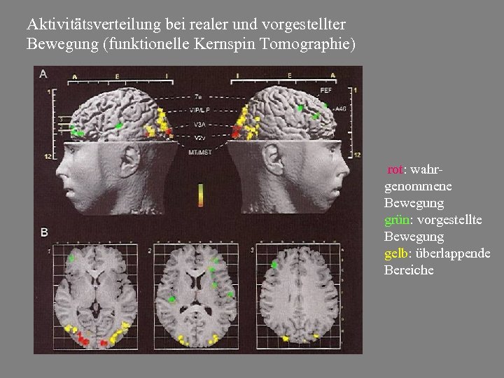 Aktivitätsverteilung bei realer und vorgestellter Bewegung (funktionelle Kernspin Tomographie) rot: wahrgenommene Bewegung grün: vorgestellte