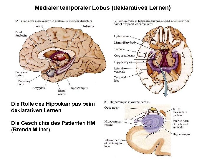 Medialer temporaler Lobus (deklaratives Lernen) Die Rolle des Hippokampus beim deklarativen Lernen Die Geschichte