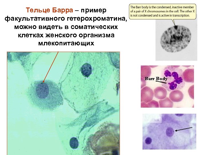 Тельце Барра – пример факультативного гетерохроматина, можно видеть в соматических клетках женского организма млекопитающих