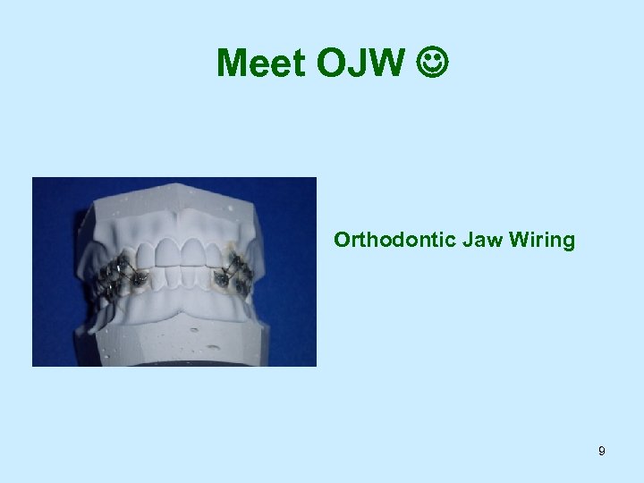 Meet OJW Orthodontic Jaw Wiring 9 