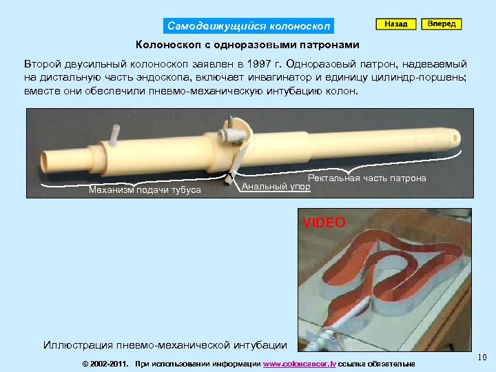Самодвижущийся колоноскоп Колоноскоп с одноразовыми патронами Второй двусильный колоноскоп заявлен в 1997 г. Одноразовый