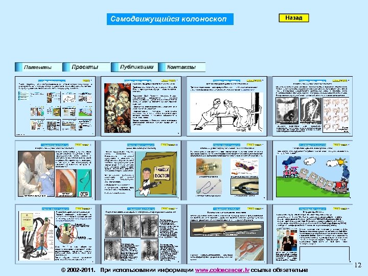 Самодвижущийся колоноскоп © 2002 -2011. При использовании информации www. coloncancer. lv ссылка обязательна 12