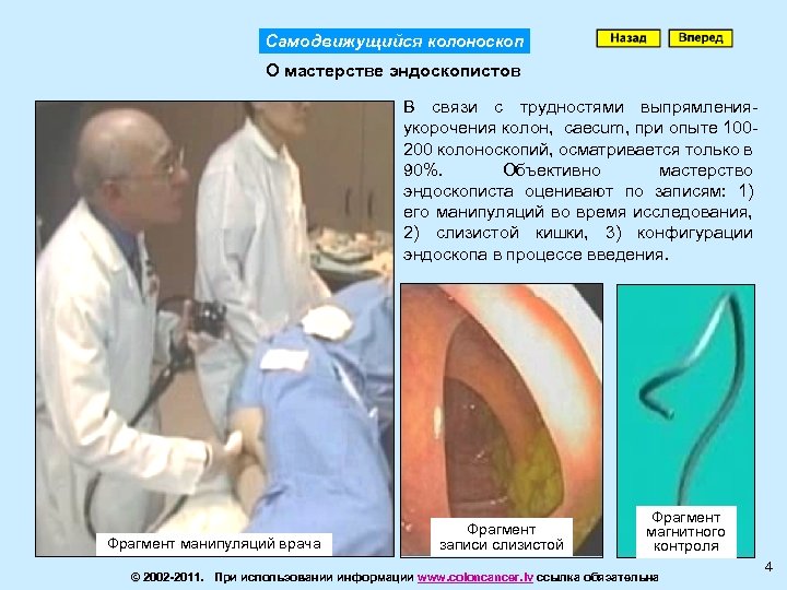 Самодвижущийся колоноскоп О мастерстве эндоскопистов В связи с трудностями выпрямленияукорочения колон, caeсum, при опыте