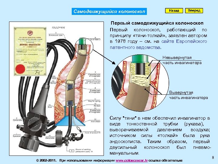 Самодвижущийся колоноскоп Первый самодвижущийся колоноскоп Первый колоноскоп, работающий по принципу «тяни-толкай» , заявлен автором
