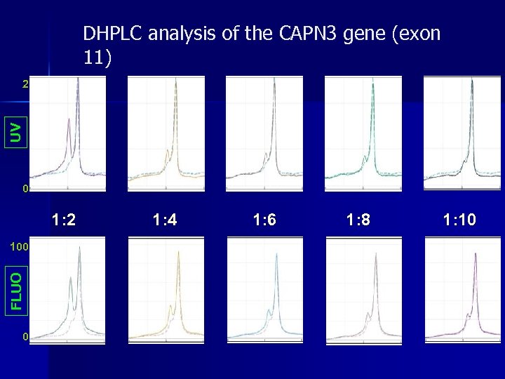 DHPLC analysis of the CAPN 3 gene (exon 11) UV 2 0 1: 2