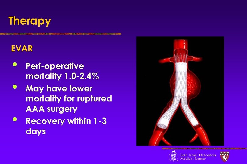 Therapy EVAR • • • Peri-operative mortality 1. 0 -2. 4% May have lower