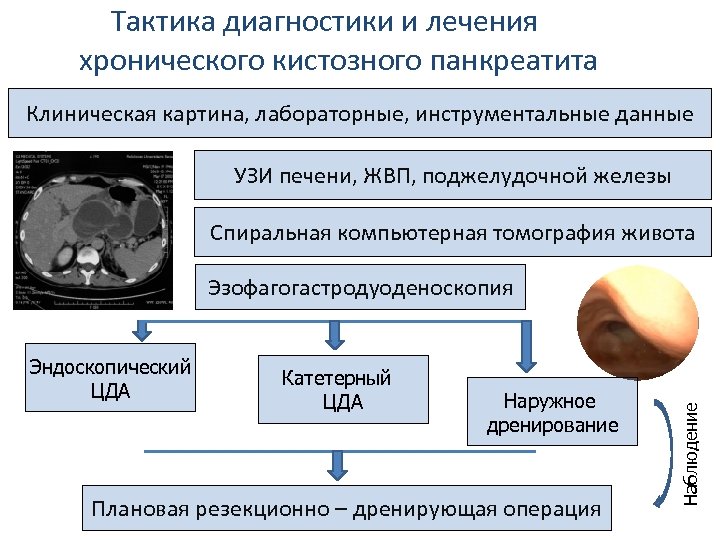 Тактика диагностики и лечения хронического кистозного панкреатита Клиническая картина, лабораторные, инструментальные данные УЗИ печени,