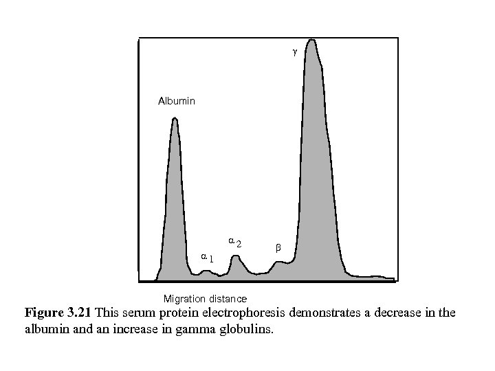 g Albumin a 1 a 2 b Migration distance Figure 3. 21 This serum