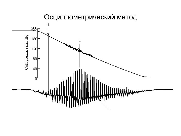 Осциллометрический метод Cuff pressure mm Hg 200 160 120 80 40 0 1 2