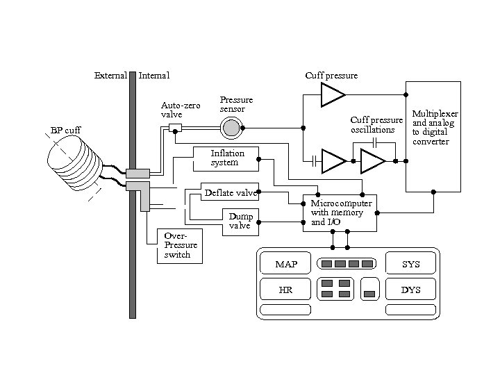 External Internal Auto-zero valve Cuff pressure Pressure sensor Multiplexer Cuff pressure and analog oscillations