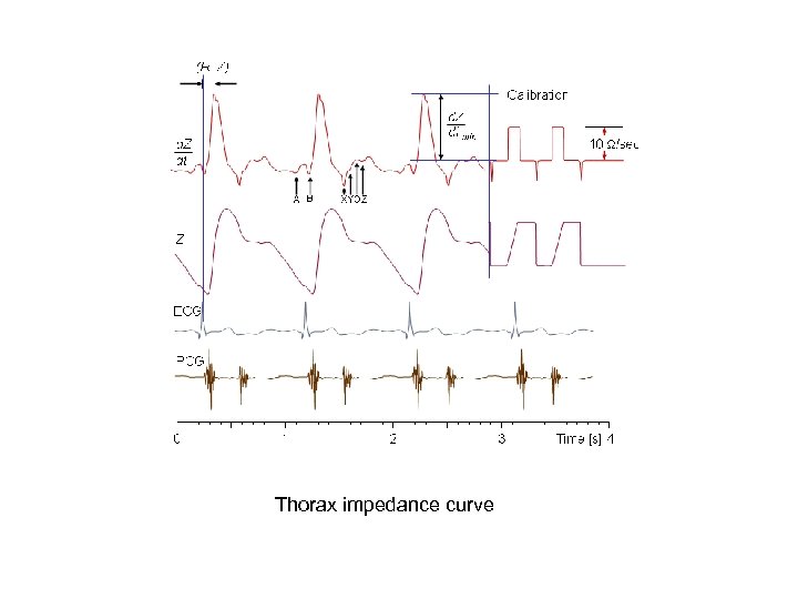 Thorax impedance curve 