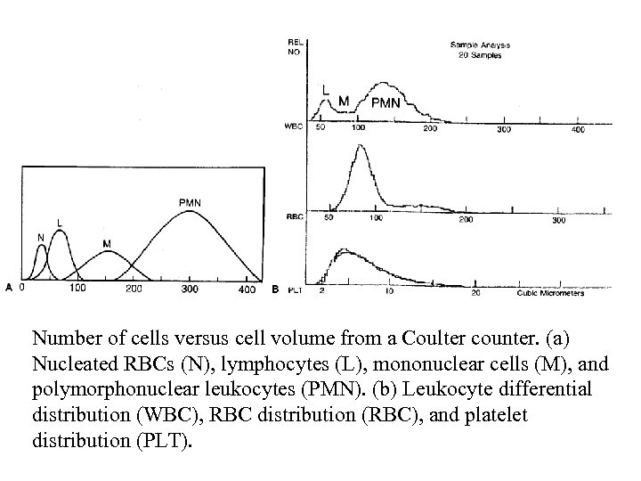 Number of cells versus cell volume from a Coulter counter. (a) Nucleated RBCs (N),