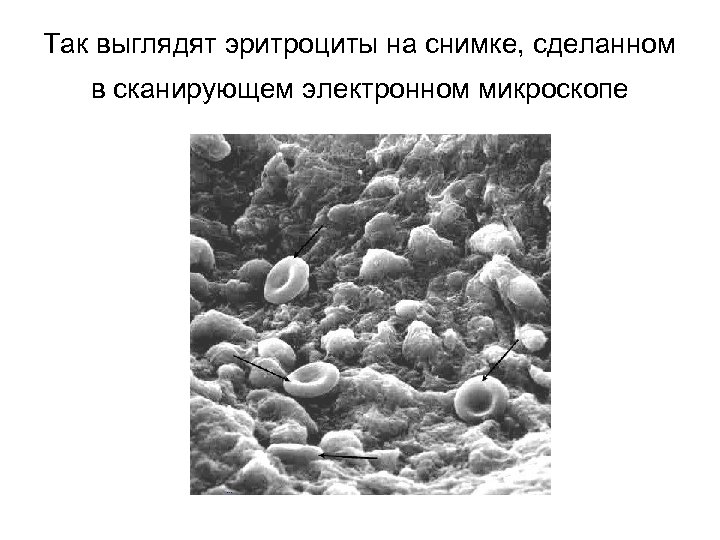 Так выглядят эритроциты на снимке, сделанном в сканирующем электронном микроскопе 