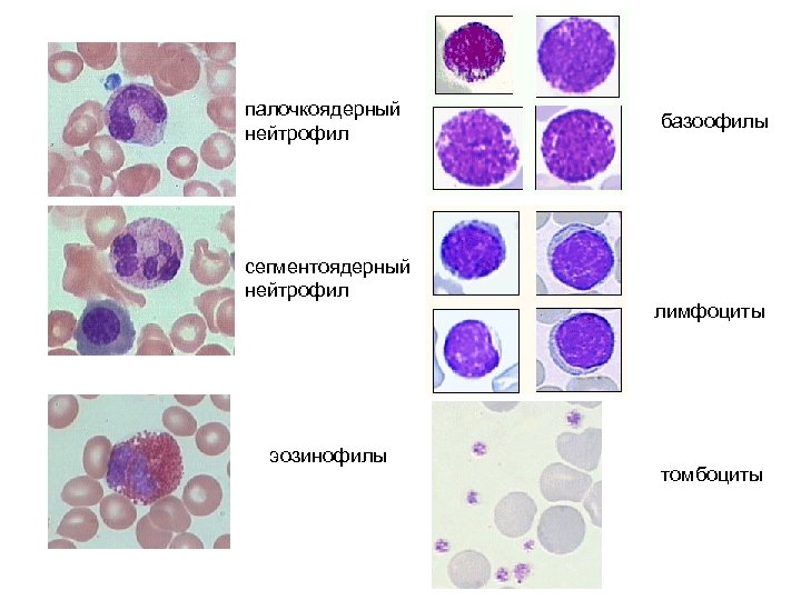 палочкоядерный нейтрофил сегментоядерный нейтрофил эозинофилы базоофилы лимфоциты томбоциты 