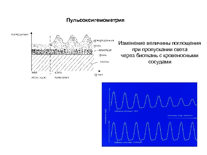 Пульсоксигемометрия Изменение величины поглощения при пропускании света через биоткань с кровеносными сосудами 