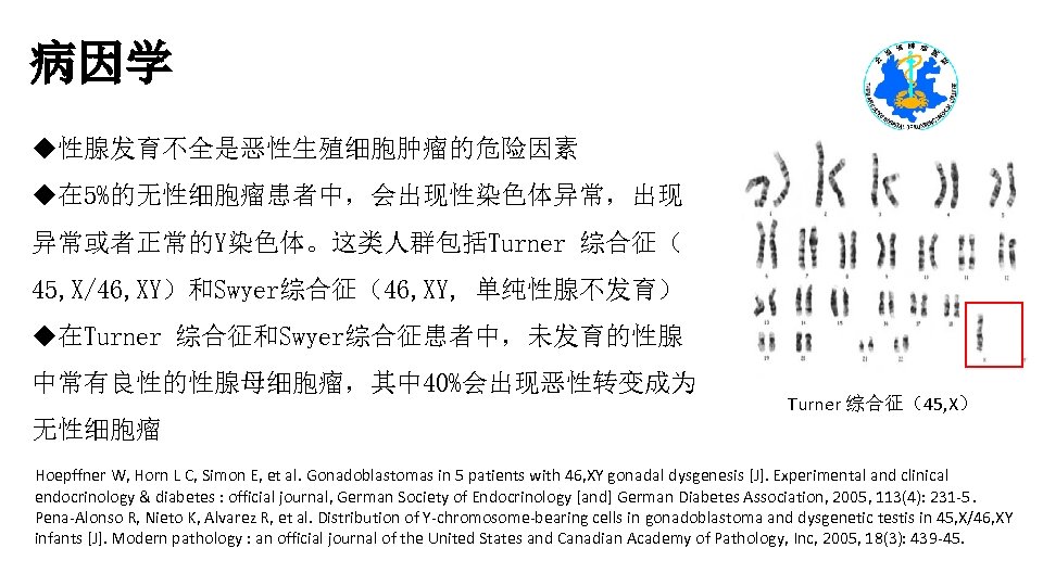 病因学 u性腺发育不全是恶性生殖细胞肿瘤的危险因素 u在 5%的无性细胞瘤患者中，会出现性染色体异常，出现 异常或者正常的Y染色体。这类人群包括Turner 综合征（ 45, X/46, XY）和Swyer综合征（46, XY, 单纯性腺不发育） u在Turner 综合征和Swyer综合征患者中，未发育的性腺 中常有良性的性腺母细胞瘤，其中